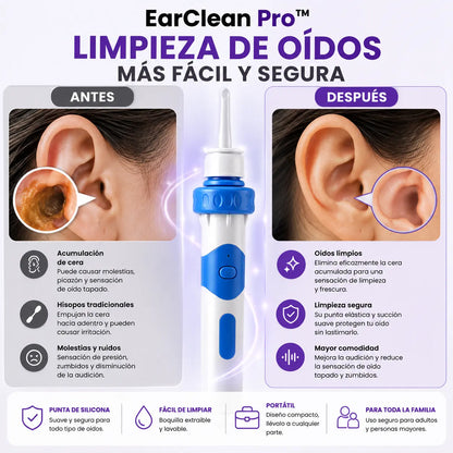 EarClean Pro™ | Limpiador de Oídos Eléctrico