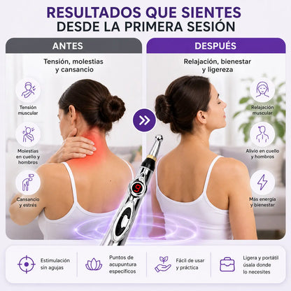 Acupen™ | Pluma de Acupuntura