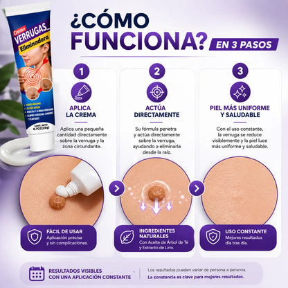 Hanel® | Crema Removedora de Verrugas