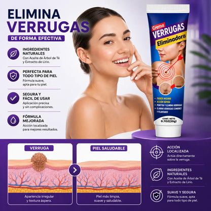 Hanel® | Crema Removedora de Verrugas