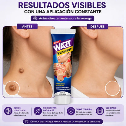 Hanel® | Crema Removedora de Verrugas