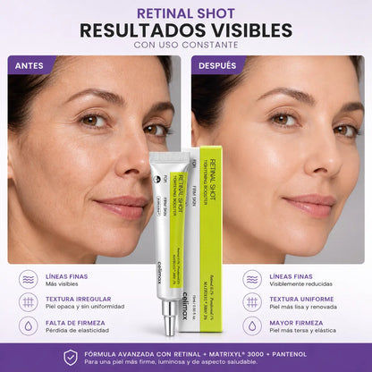 Retinal Shot™ | Crema Reafirmante Antiedad
