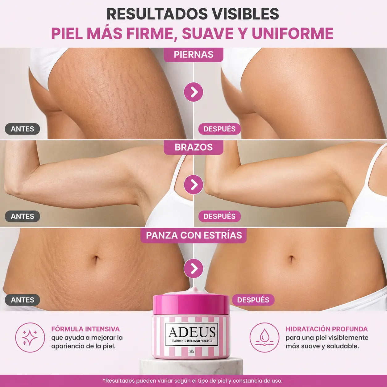 ADEUS™ | Crema Corporal Reafirmante 300gr