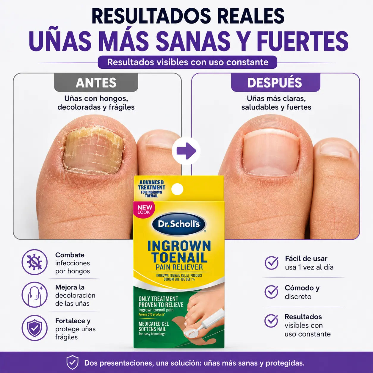 20 Parches para uña enterrada y hongos