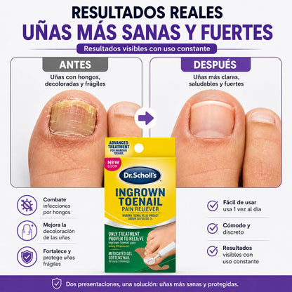 20 Parches para uña enterrada y hongos