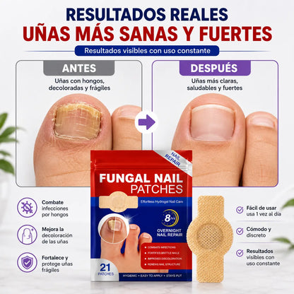 Parches Para Hongos | 21 piezas